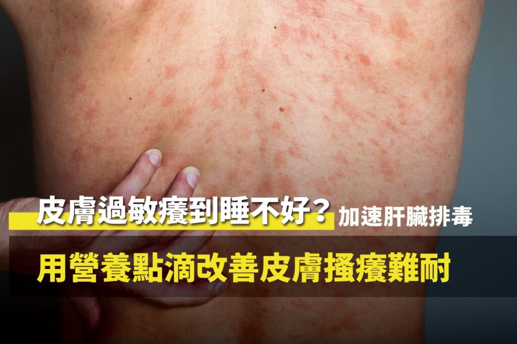 承包商老闆長期皮膚過敏搔癢接受客製化營養點滴調理排毒康復