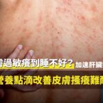 承包商老闆長期皮膚過敏搔癢接受客製化營養點滴調理排毒康復