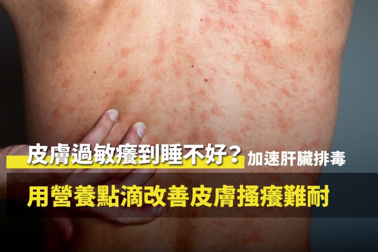 承包商老闆長期皮膚過敏搔癢接受客製化營養點滴調理排毒康復