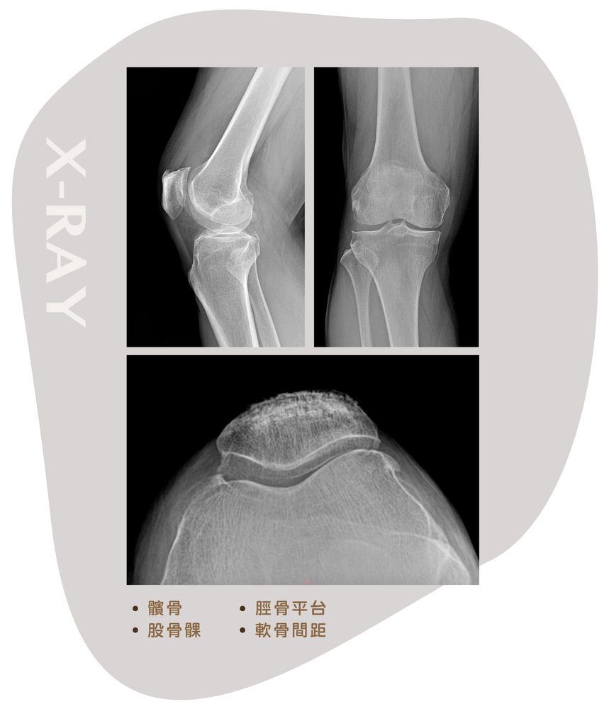 knee-x-ray-image
